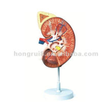 Human Kidney Model